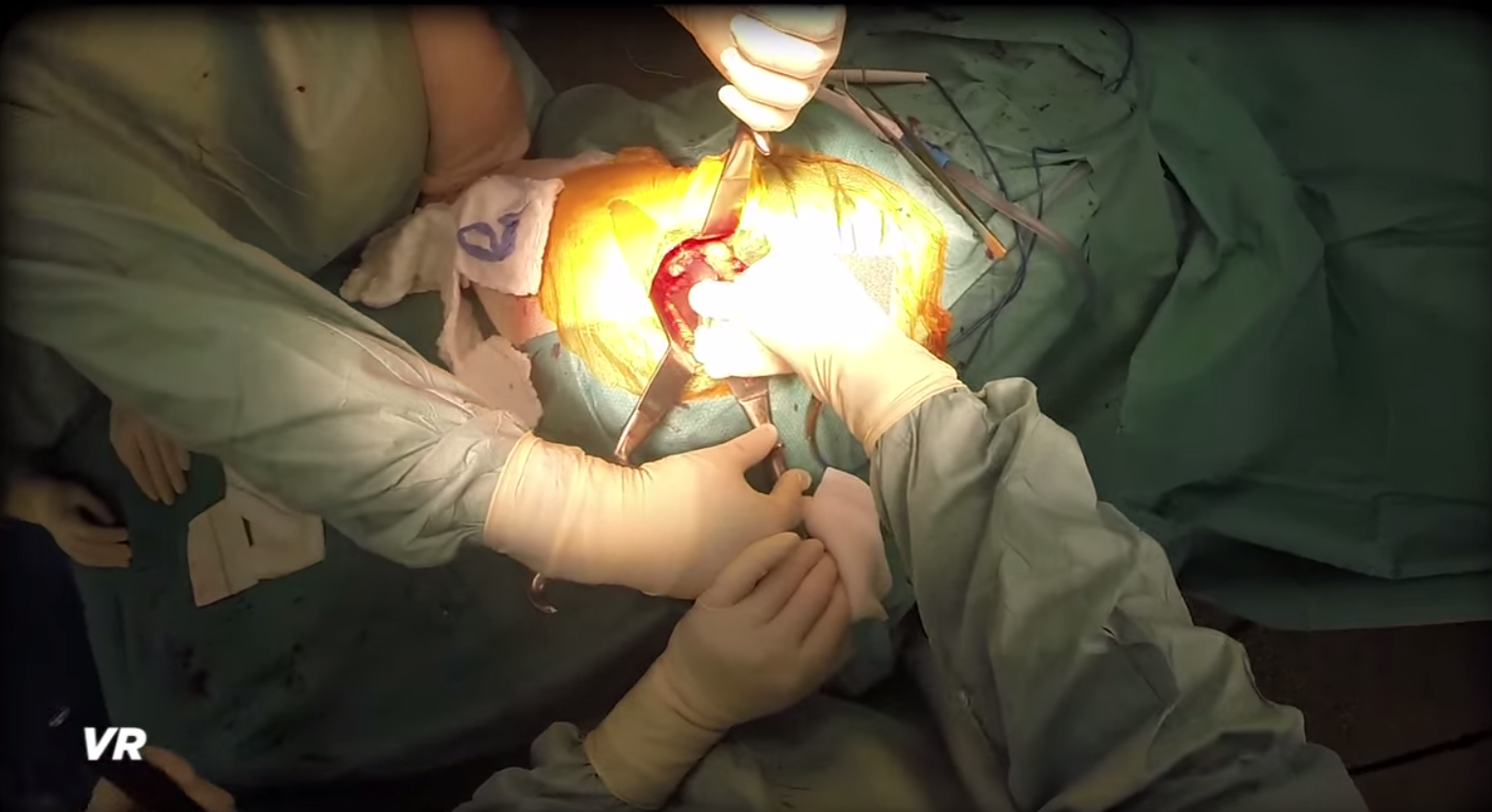 Virtual reality, Barbie taler, telefonfis- podcast #155